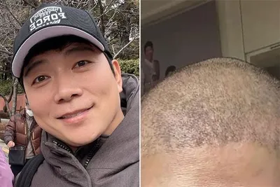 “가족은 옆에 있어주는 것” 암 투병 동생 위해 함께 삭발한 김재욱의 선택