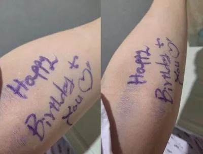 암 수술 뒤 팔에 남은 ‘생일 축하’…음료 12잔으로 답한 환자의 감동 사연